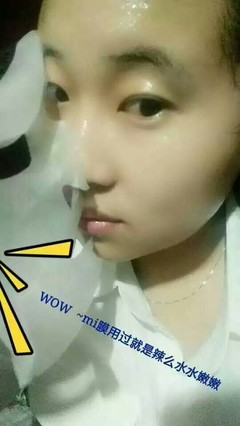 mi膜多少钱