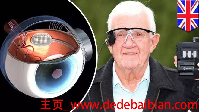 仿生眼在美国的价格是多少