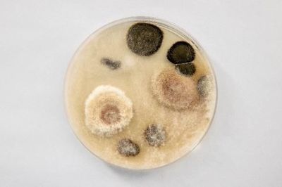 灰尘中有多少种微生物