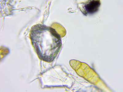 灰尘中有多少种微生物