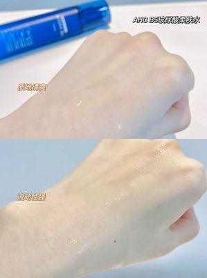 皮肤水油测试水分该是多少